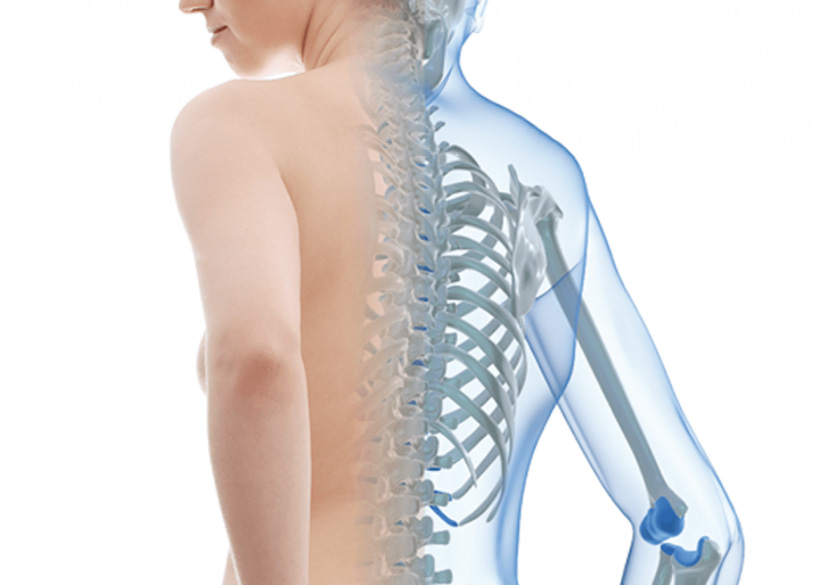 Osteoporosis – Calcibone Osteoporosis - Calcibone