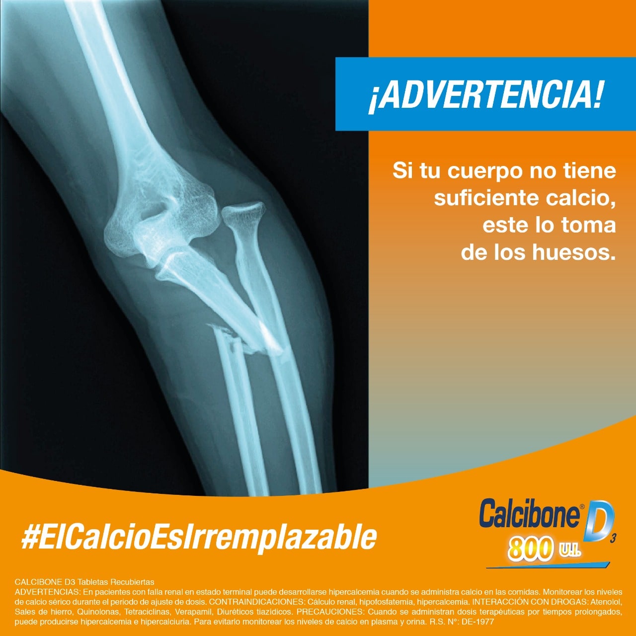 Si tu cuerpo no tienen suficiente calcio, este lo toma de los huesos - calcibone-min