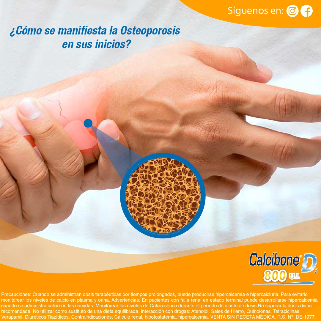 Como se manifiesta la osteoporosis - Calcibone D