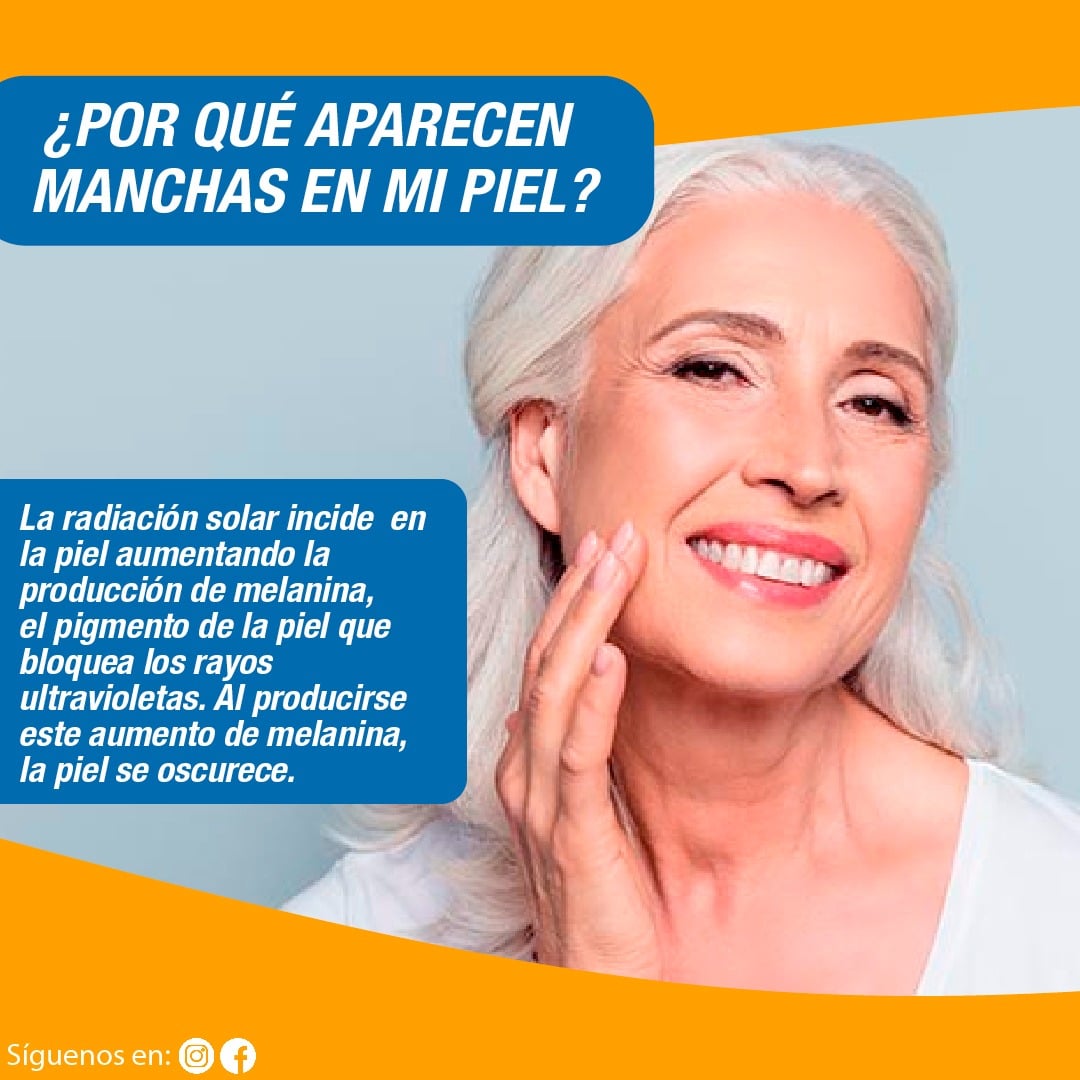 ¿Por qué aparecen esas manchas mi Piel?