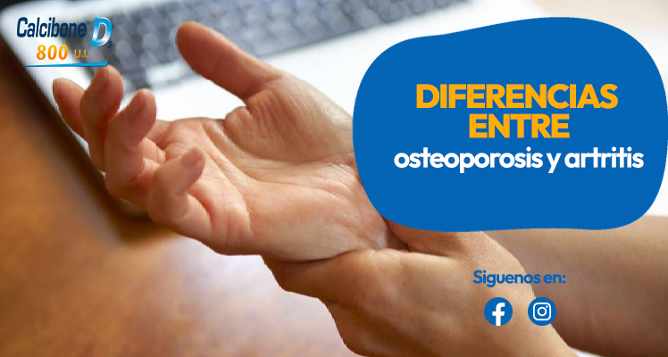 Conoce las diferencias entre osteoporosis y artritis